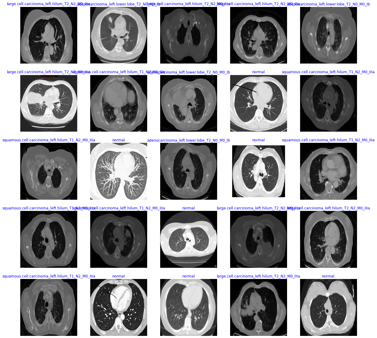 Pulmonary Tumors Research